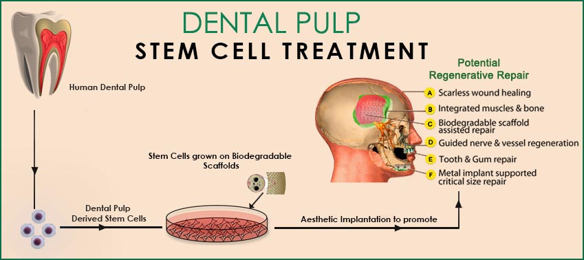 成人牙科干细胞可以分化成许多牙科成分