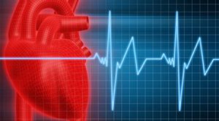HEART ARRHYTHMIA. Why are there and how to treat them